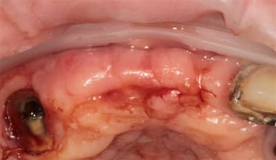 2010 10 04 0312r cwboai - Eugenol