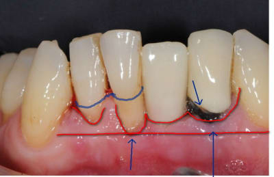 2011 06 22 170409 yargh8 - Eugenol