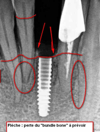 2011 06 22 171534 2 flmvrj - Eugenol