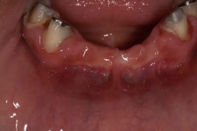 20110108  mg 0021 lu2wzz - Eugenol