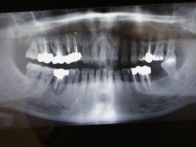 2011 of09pa - Eugenol