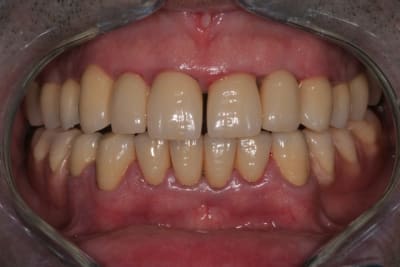 2012 04 18 08 43 10 wt10l7 - Eugenol