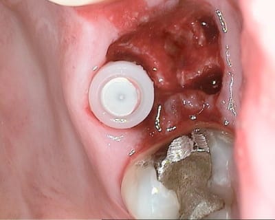 20120126 122313 wl7dqh - Eugenol