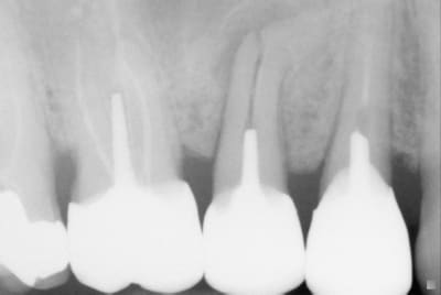 20120618 1 1 - Eugenol