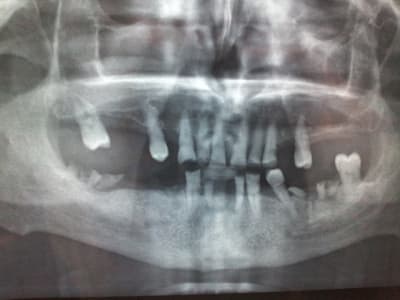 20121009 201404 yt7sni - Eugenol