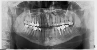 2013 xgirxo - Eugenol