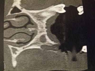 20140401 204411 sy5rwz - Eugenol