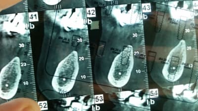 20141108 114319 v4y76v - Eugenol