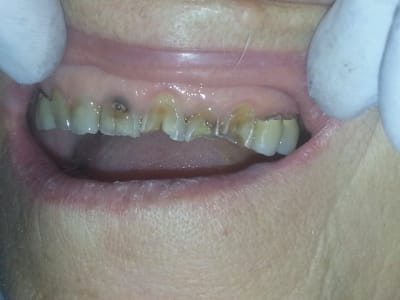 20150717 090721 sqlau2 - Eugenol