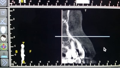 20151215 173325 yirqsx - Eugenol