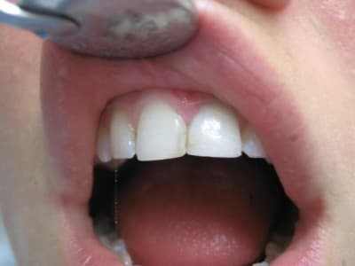 21apres s40fag - Eugenol