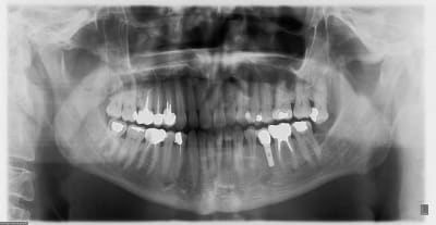 21septembre2009 re7fmt - Eugenol
