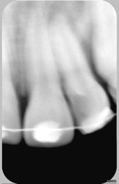 22 21 19 4 2006 n2szdz - Eugenol