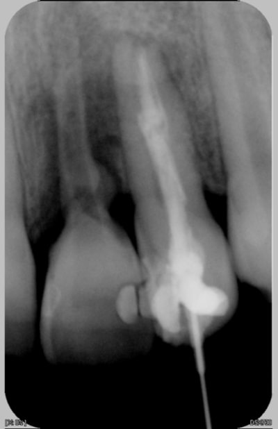 22 21 30 2 2007 lk16je - Eugenol