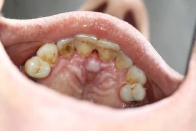 24 03  2  pwxa0d - Eugenol