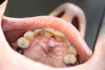 24 03 udci0s - Eugenol