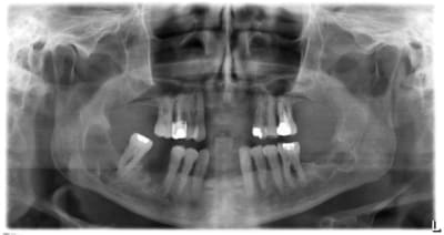 25 11 10 qvbjbp - Eugenol