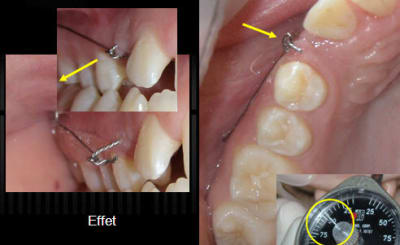 26 03 2013 10 30 29 o7rrua - Eugenol