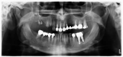 281 ftomyr - Eugenol