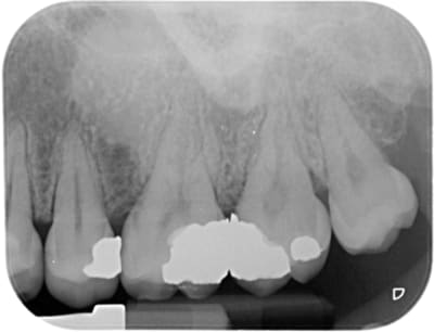 2923 x 20160211 170857 x7wkcjexhnvf 4 bfuyl8 - Eugenol