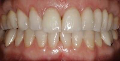 294dae20 b376 45eb 89fa 77d61d470ed1 wi44um - Eugenol