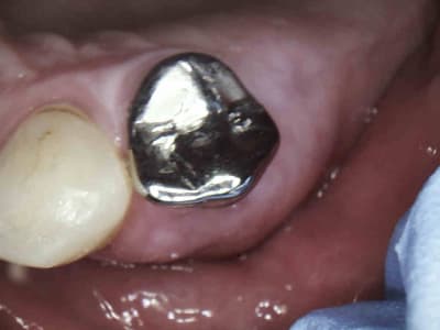 2 lps3eh - Eugenol