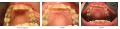 2 mois e5kfqo - Eugenol