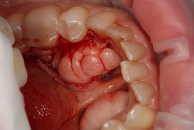 2 nai4cv - Eugenol