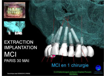 30 mai zkbd2j - Eugenol