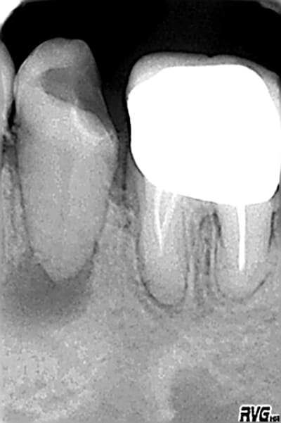 35 ydihq5 - Eugenol