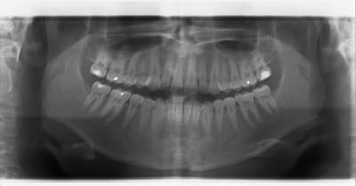 363 20120118 15 32 07 whtfzh - Eugenol