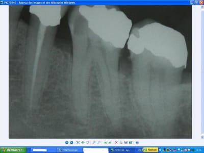 36préop ism6hn - Eugenol