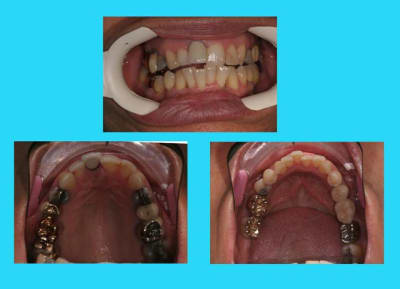 3 gpyr10 - Eugenol