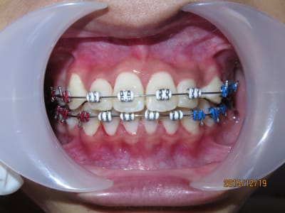 3 nlb8e3 - Eugenol