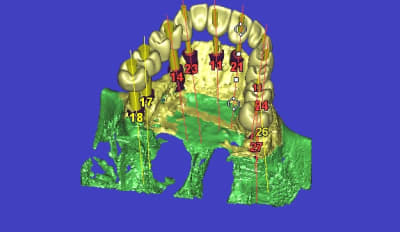 3d15 gvvld7 - Eugenol