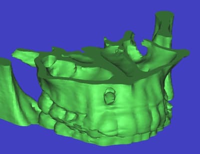 3d1 smtf5y - Eugenol