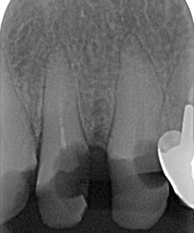 407 x 000001d4 3 zrxgqz - Eugenol