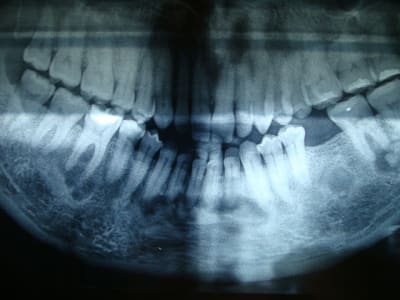 424 dxetdx - Eugenol