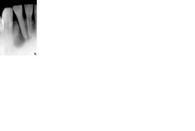 42 retro cueov3 - Eugenol