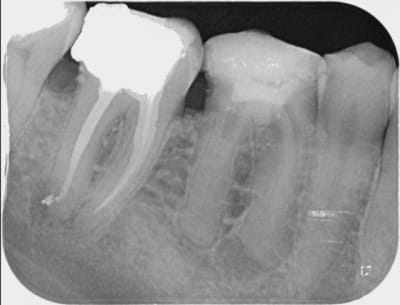 46 gw26zt - Eugenol