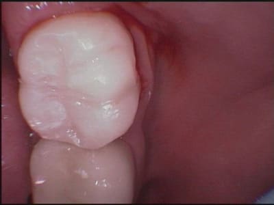 47 ct mo5k9j - Eugenol