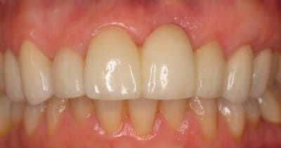4   large  hhulti - Eugenol