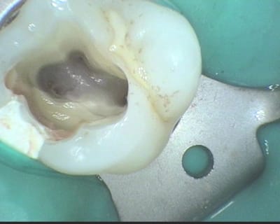 4e canal gjwo7j - Eugenol