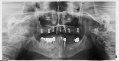 4mois cf1ihd - Eugenol
