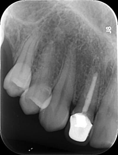 5454 xxx2tl - Eugenol