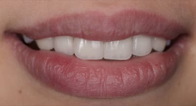 5730 09 vebmym - Eugenol