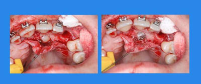 5  jpeg zzivfh - Eugenol