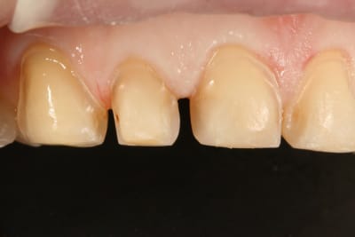 6 dents pr par es x0xesq - Eugenol