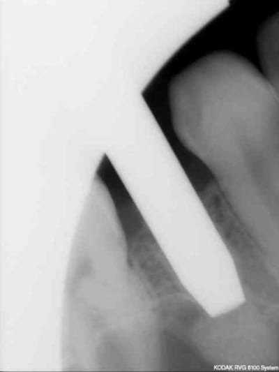 6 summers kbyyuc - Eugenol