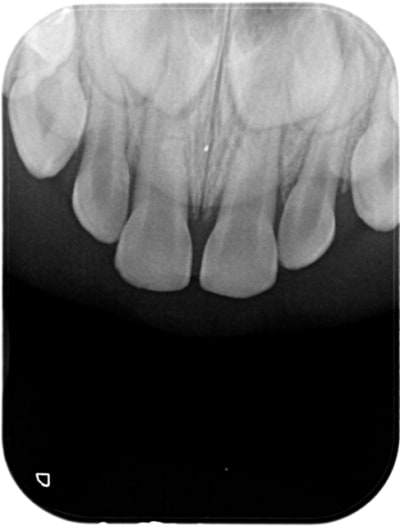 717 x 20150609 160307 xgbtjvhl m67 3 orucs0 - Eugenol